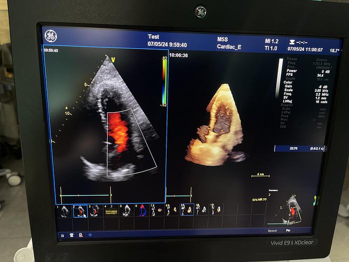 Gebraucht GE Vivid E9 XDClear Ultraschallgerät mit 2 Sonden