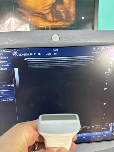 Gebraucht GE Logiq P5 Ultraschallgerät mit drei Sonden und Drucker