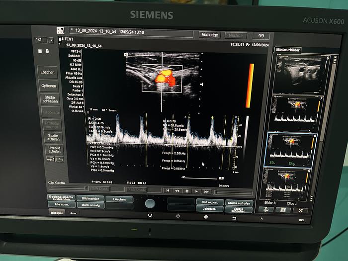 Used Siemens Acuson X600 Ultraschallgerät mit drei Sonden