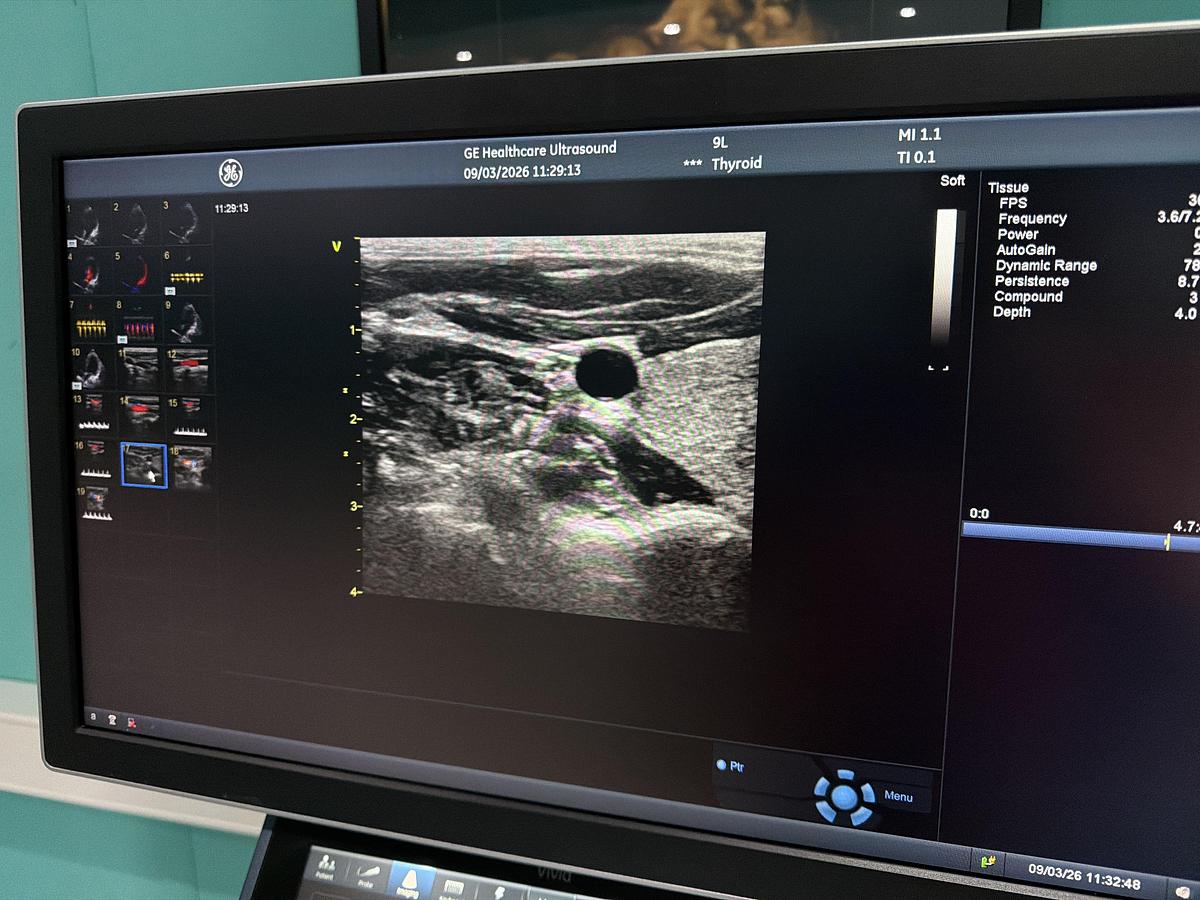 Gebraucht GE Vivid S70N Ultrasound 