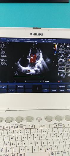 Gebraucht philips ultrasound cx50 mit 2 Sonde linear und sektor