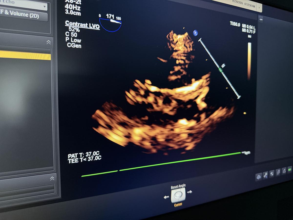 Gebraucht Philips X8-2T compact TEE Ultraschallsonde