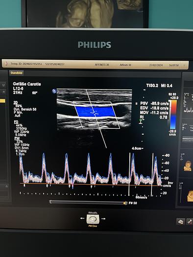 Used Philips Affiniti 30 Ultraschallgerät mit 3 Sonden und Drucker