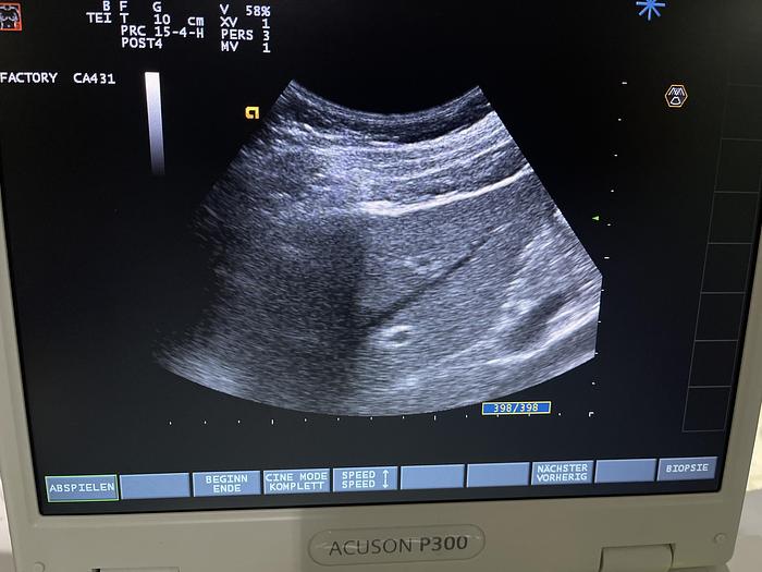 Used Esaote CA431 Konvex Ultraschallsonde