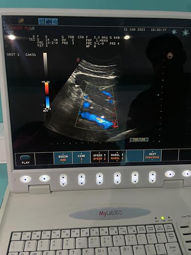 Gebraucht Esaote MyLab30CD Ultraschallgerät mit zwei Sonden