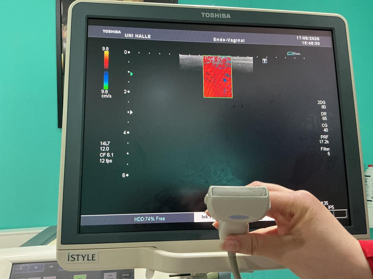 Gebraucht Toshiba PLT-1204AT Linear Ultraschallsonde