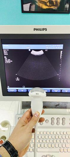 Gebraucht Philips V8-4 3D/4D Volumen Ultraschallsonde