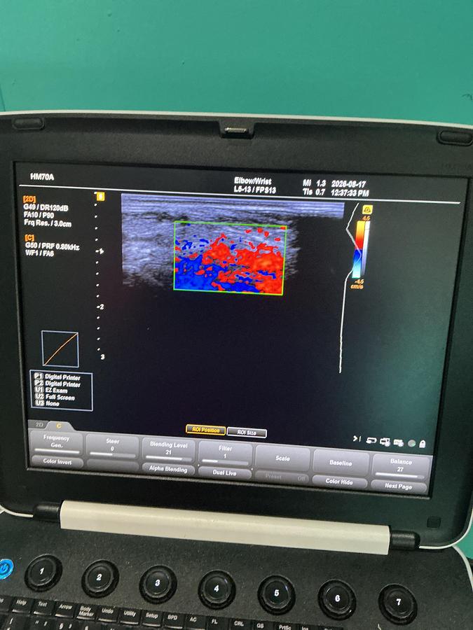 Gebraucht Samsung Medison HM7AF1B Ultraschallgerät mit zwei Sonden