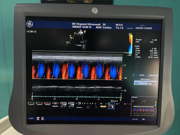 Gebraucht GE 3S Sektor Ultraschallsonde