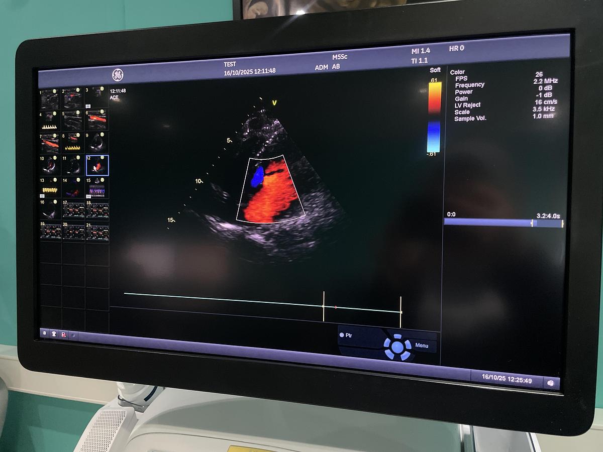 Gebraucht GE Vivid E95 v202 Ultraschallgerät mit zwei Sonden