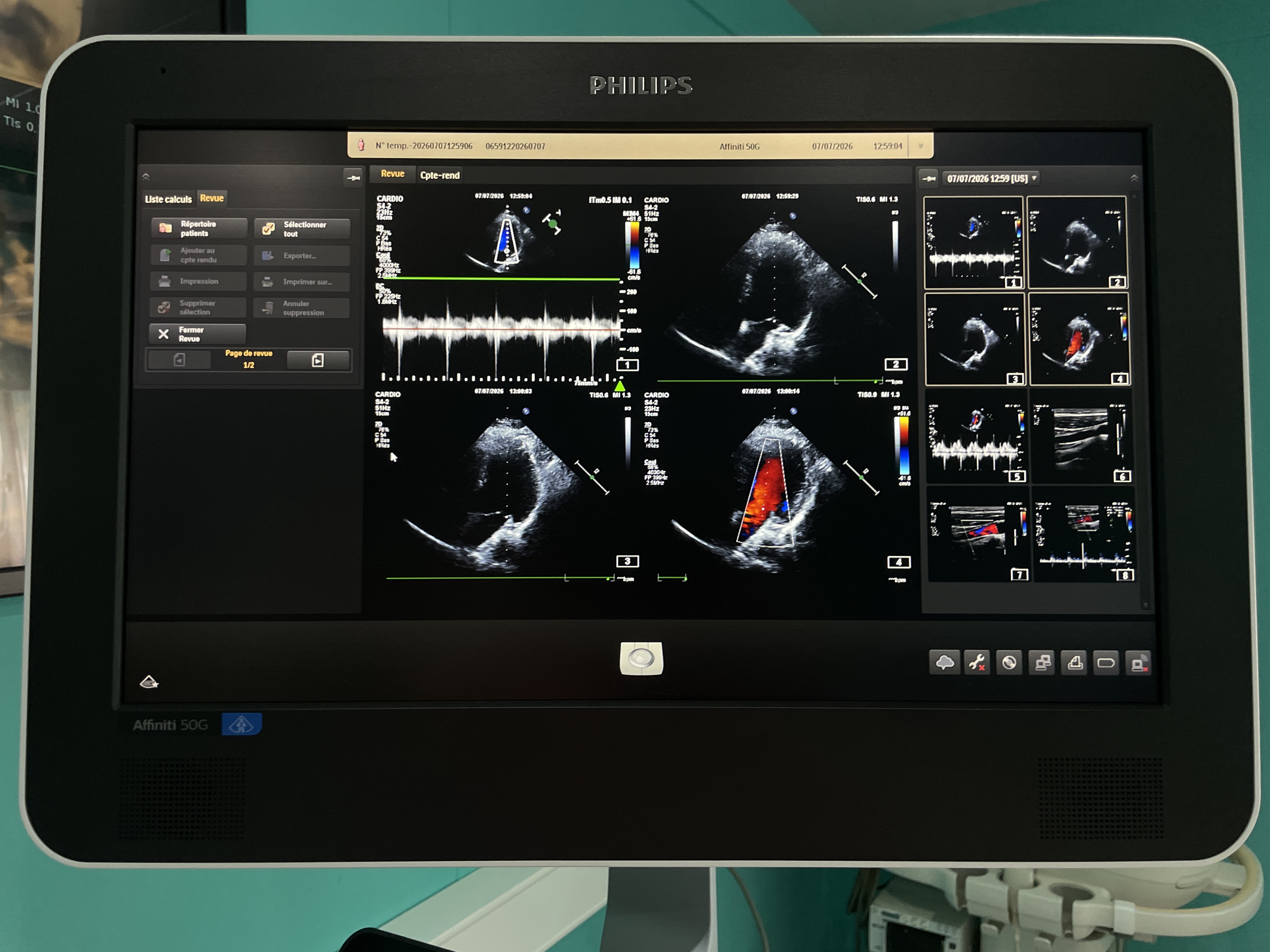 Gebraucht Philips S4-2 Kardio Ultraschallsonde