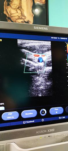 Gebraucht Siemens Acuson X300 Ultraschallgerät mit 3 Sonden