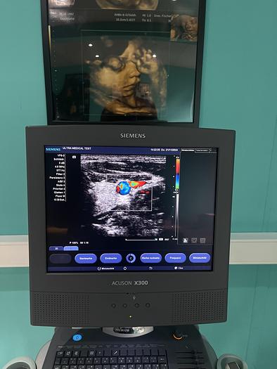 Used Siemens ACUSON X300 Ultraschallgerät mit drei Sonden 