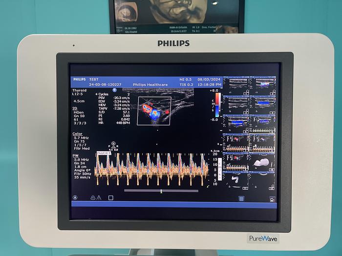 Gebraucht Philips HD15 Ultraschallgerät mit zwei Sonden 