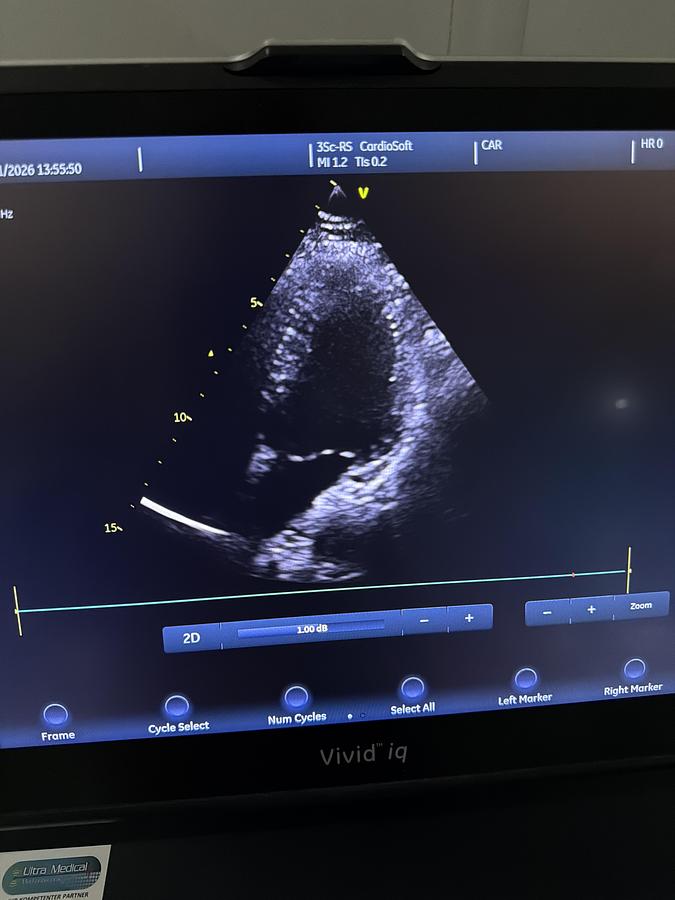 Gebraucht GE 3SC-RS Kardio Ultraschallsonde