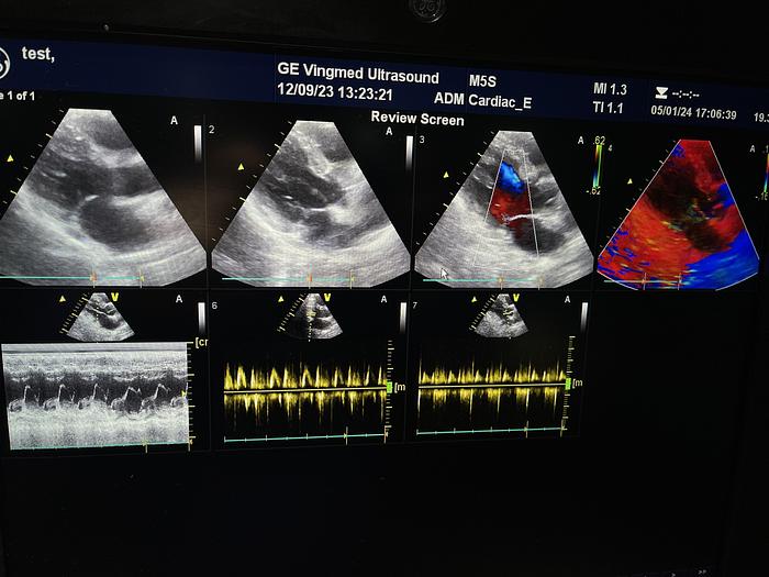 Gebraucht GE Healthcare Vivid E9 Ultraschall Gerät mit zwei Sonden