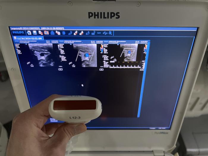 Used Philips L12-3 Linear Ultraschallsonde