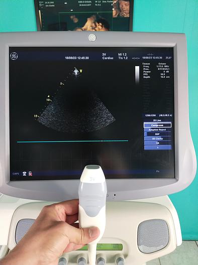 Gebraucht GE Vivid 7 Ultraschallgerät mit Konvex ,Linear ,Sektor Sonde