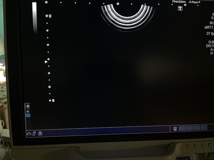 Gebraucht Toshiba Aplio 500 Ultraschallgerät mit 3 Sonden