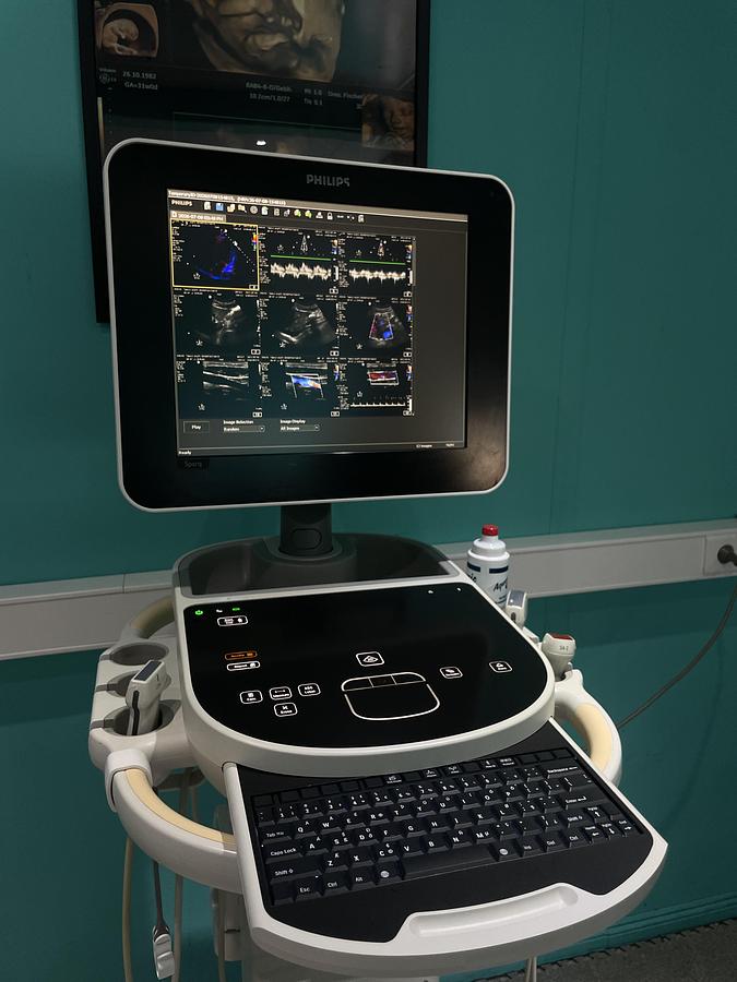 Gebraucht Philips Sparq Ultraschallgerät mit drei Sonden und Drucker
