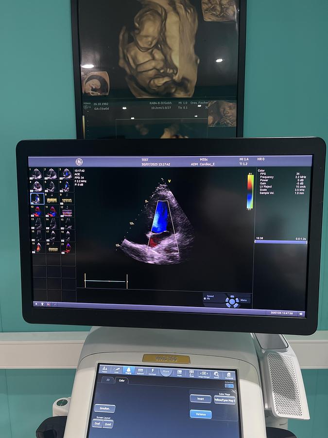 Gebraucht GE Vivid E95 V202 Ultraschallgerät mit M5Sc-D Kardiosonde