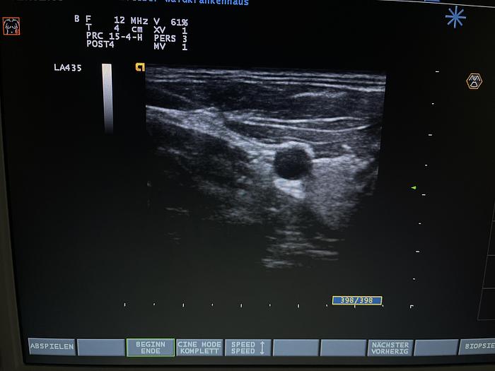 Used Esaote LA435 Ultraschallsonde 