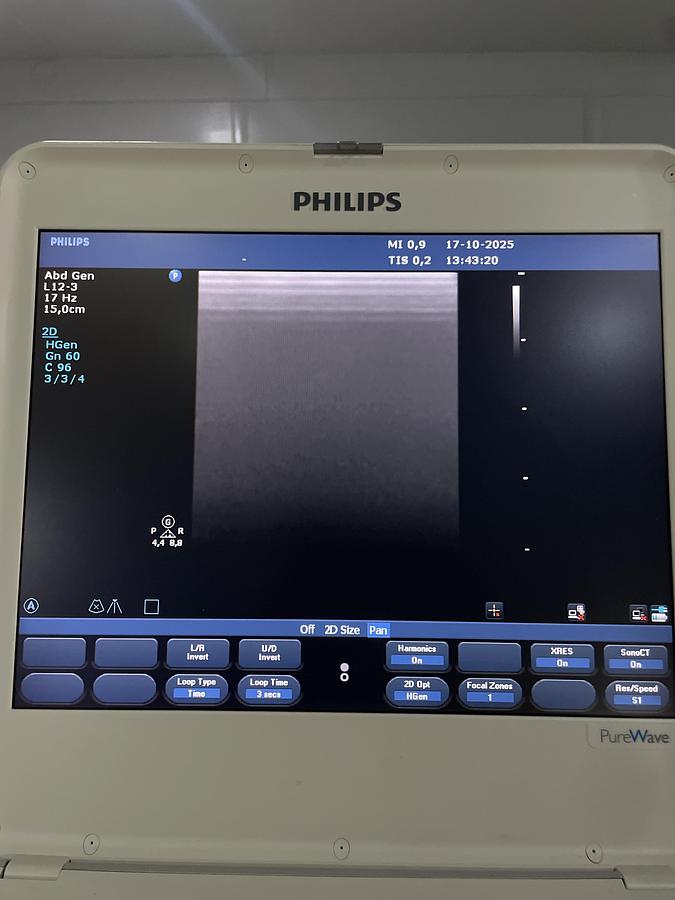 Gebraucht Philips L12-3 Linear Ultraschallsonde