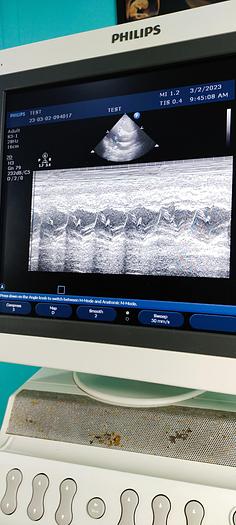 Gebraucht Philips HD11XE Ultraschallgerät mit 3 Sonde