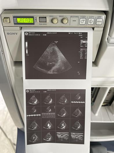 Gebraucht GE LOGIQ E9 Ultraschallgerät mit 2 Sonden und Drucker 
