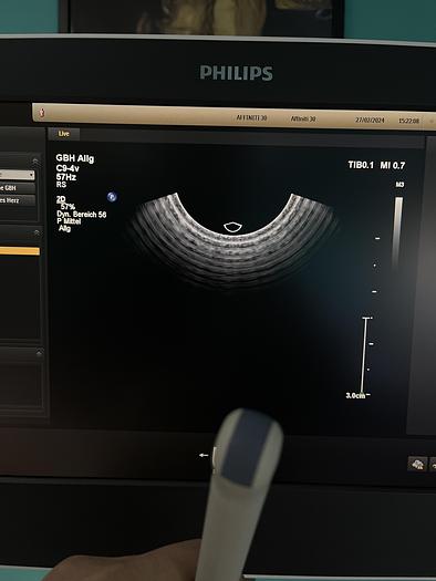 Used Philips Affiniti 30 Ultraschallgerät mit 3 Sonden und Drucker