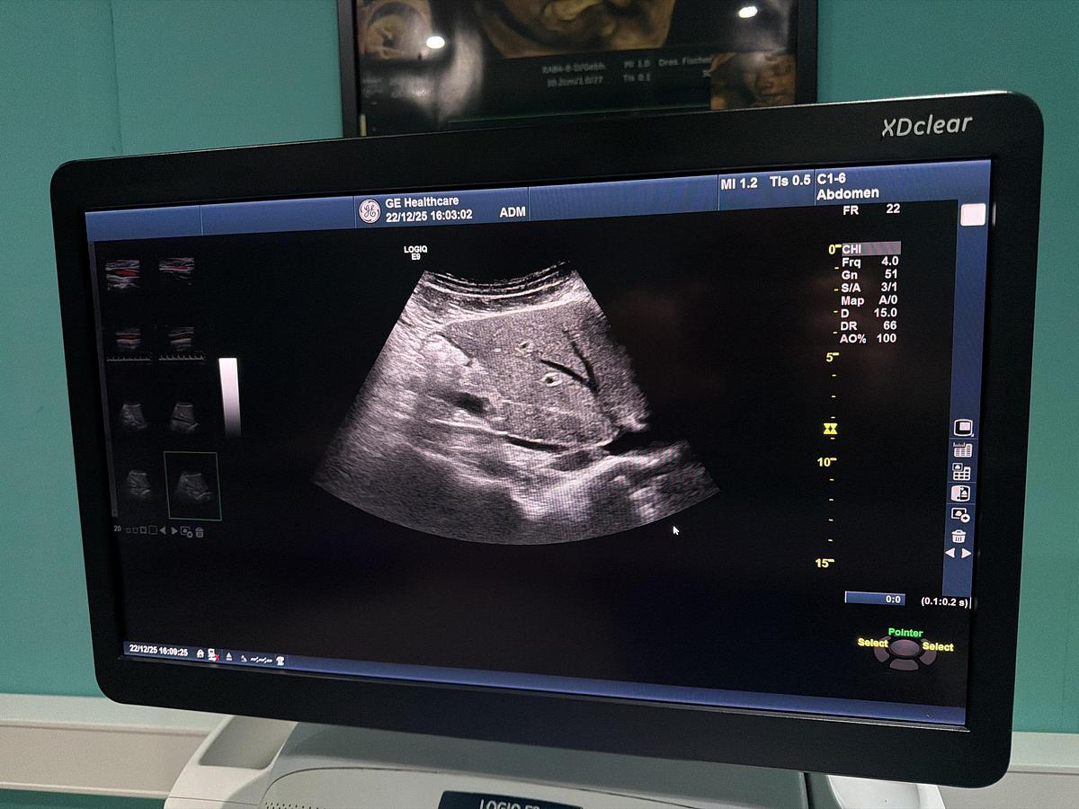 Gebraucht GE LOGIQ E9 XDClear Elastography Ultraschallgerät mit zwei Sonden  