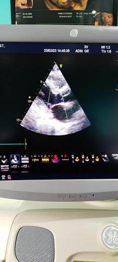 Gebraucht GE Vivid 7 Ultraschallgerät