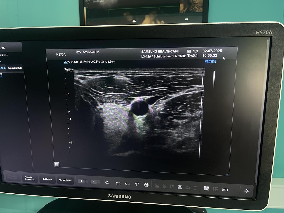 Gebraucht Samsung HS70A Ultraschallgerät mit drei Sonden