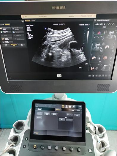 Gebraucht Philips V6-2  3D/4D  Volumen Ultraschallsonde