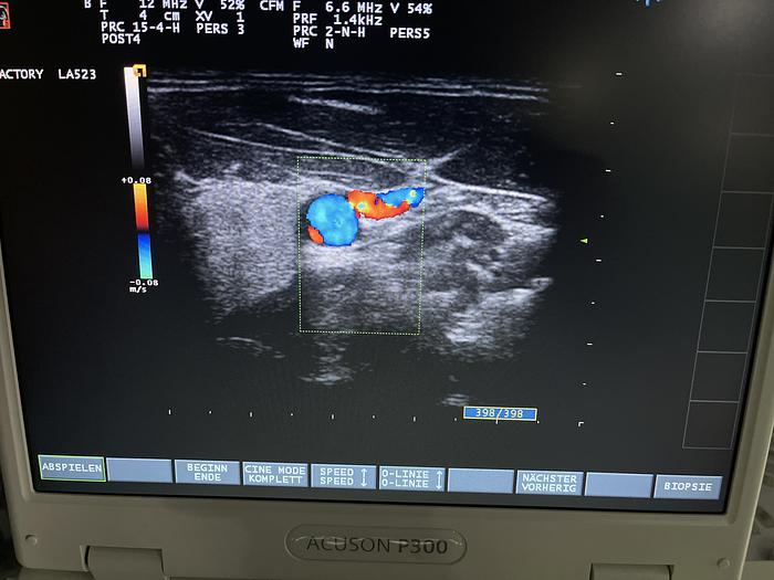 Used Esaote LA523 Linear Ultraschallsonde 