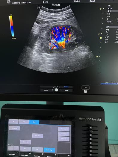 Gebraucht GE Versana Premier Ultraschallgerät mit drei Sonden
