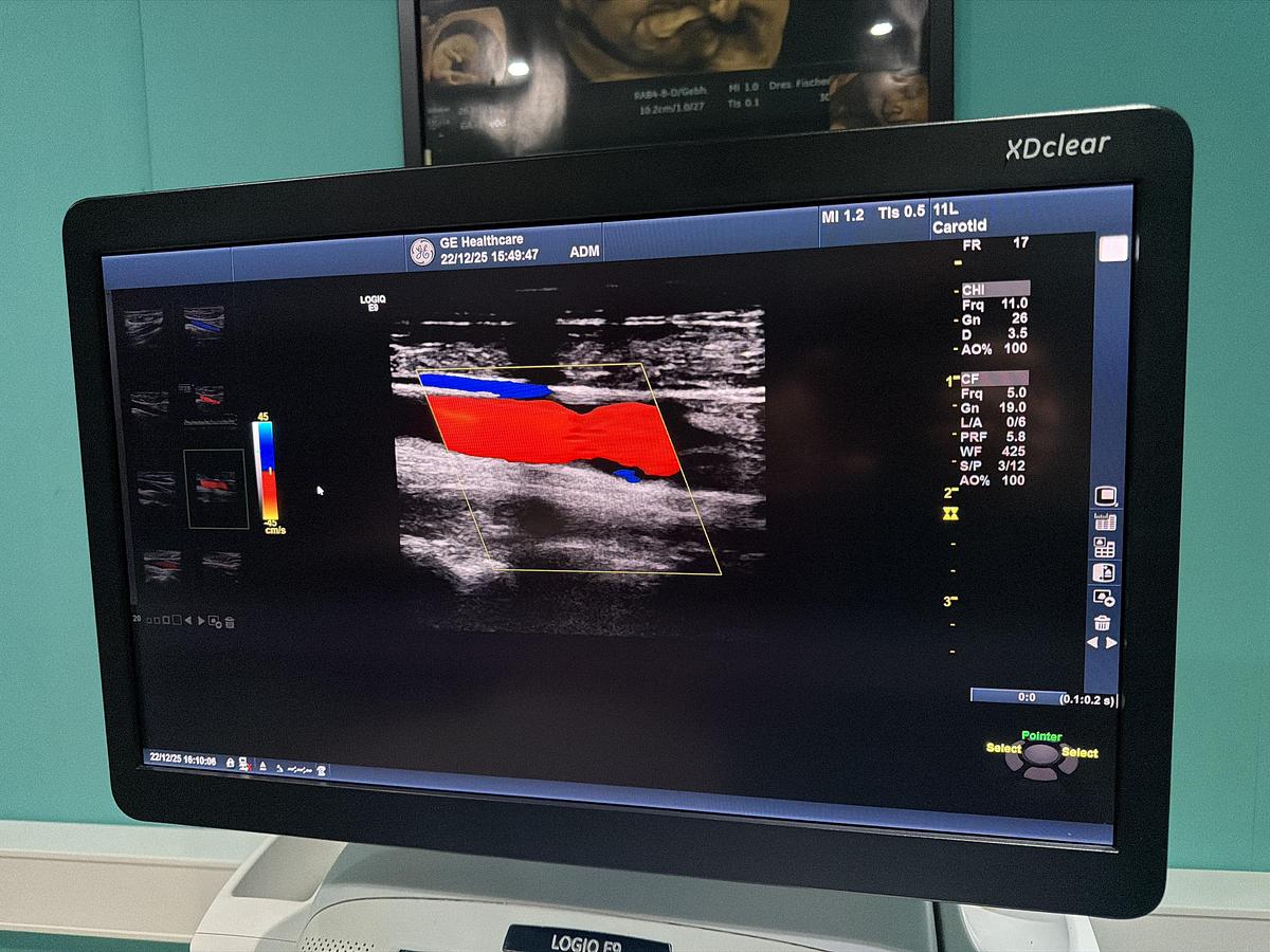 Gebraucht GE LOGIQ E9 XDClear Elastography Ultraschallgerät mit zwei Sonden  
