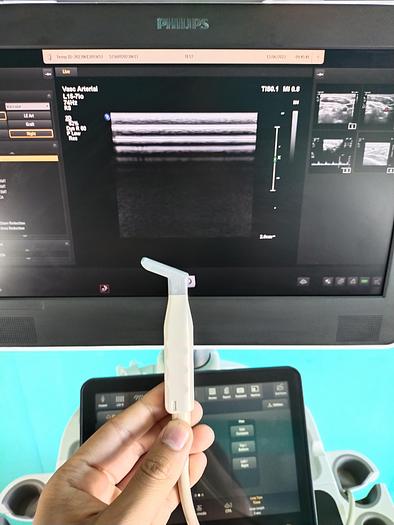 Gebraucht Philips  Affiniti 70G Screen Ultrasound Scanner 