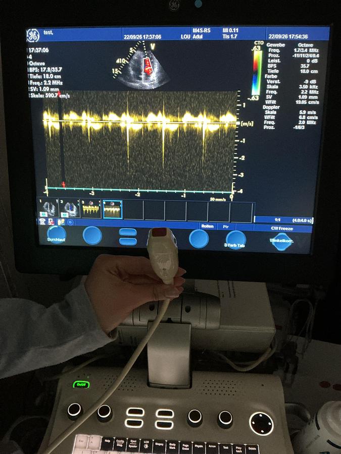 Gebraucht GE 10S-RS Kardio Ultraschallsonde