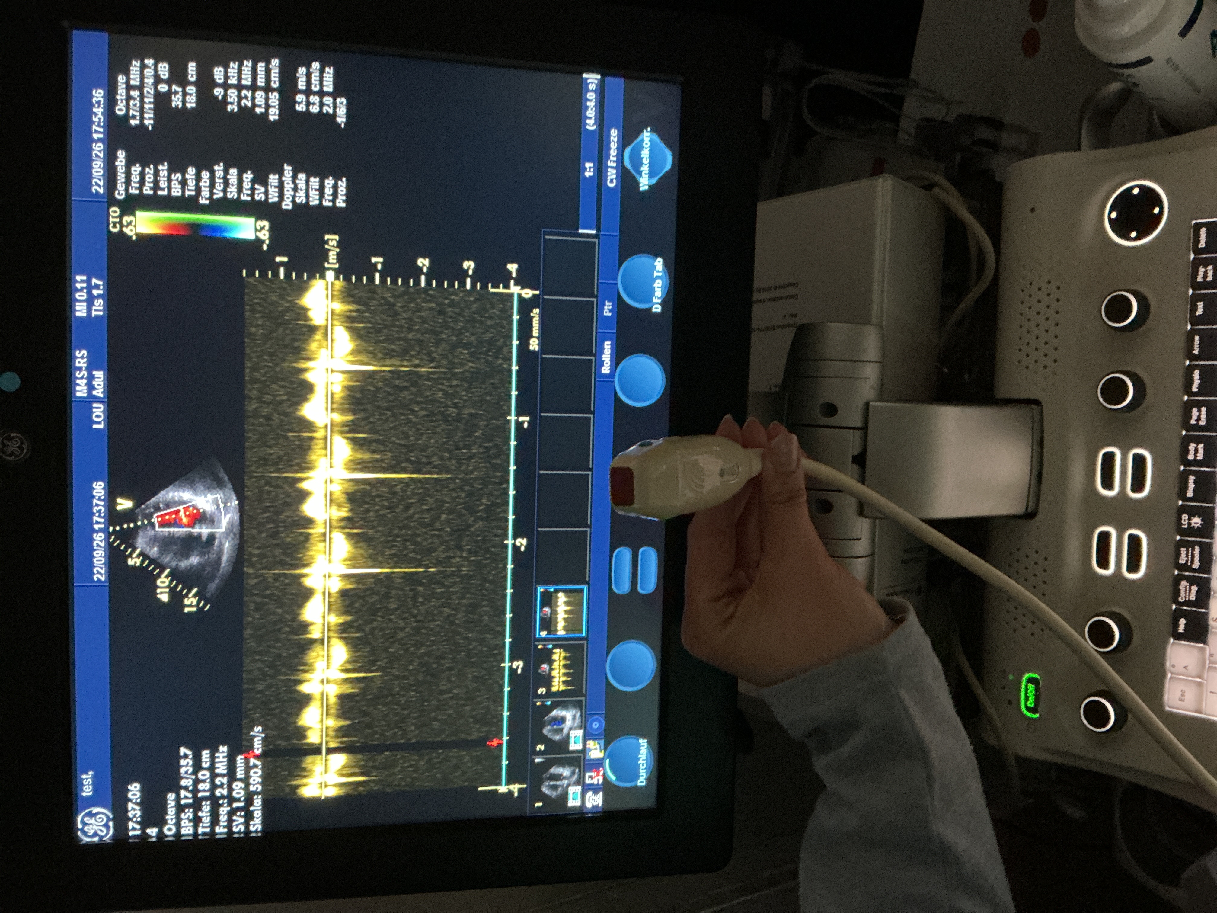 Gebraucht GE 10S-RS Kardio Ultraschallsonde