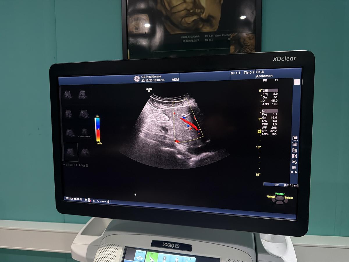 Gebraucht GE LOGIQ E9 XDClear Elastography Ultraschallgerät mit zwei Sonden  