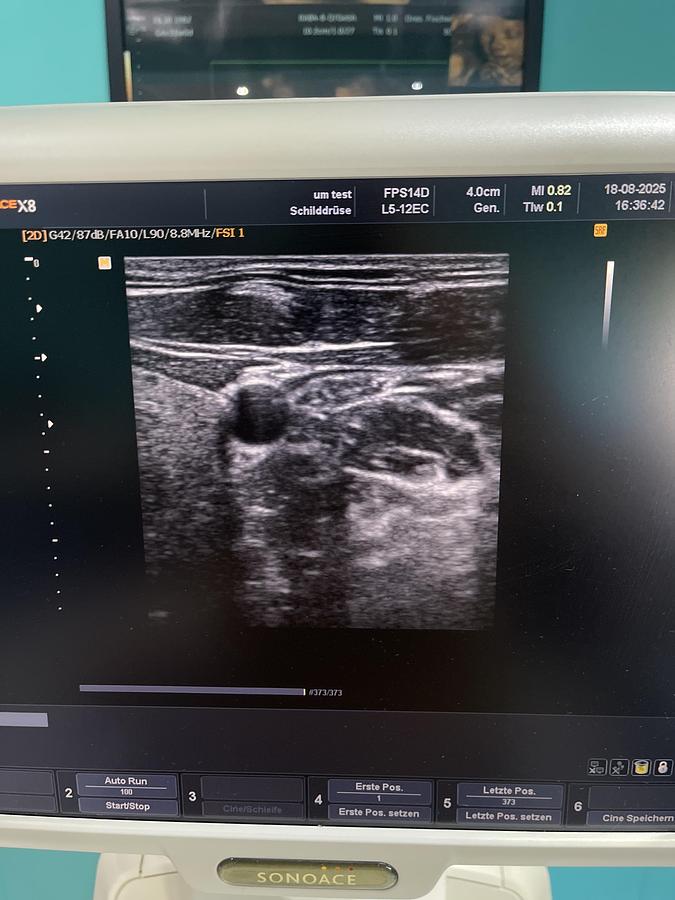 Gebraucht SonoAce X8 Ultraschallgerät mit drei Sonden und Drucker