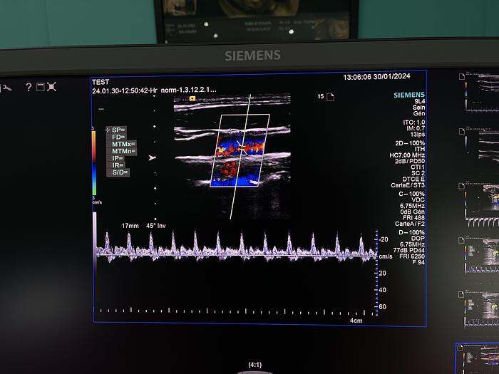 Gebraucht HELX Evoulution Acusion S2000 von Siemens Ultraschall Gerät mit drei Sonden
