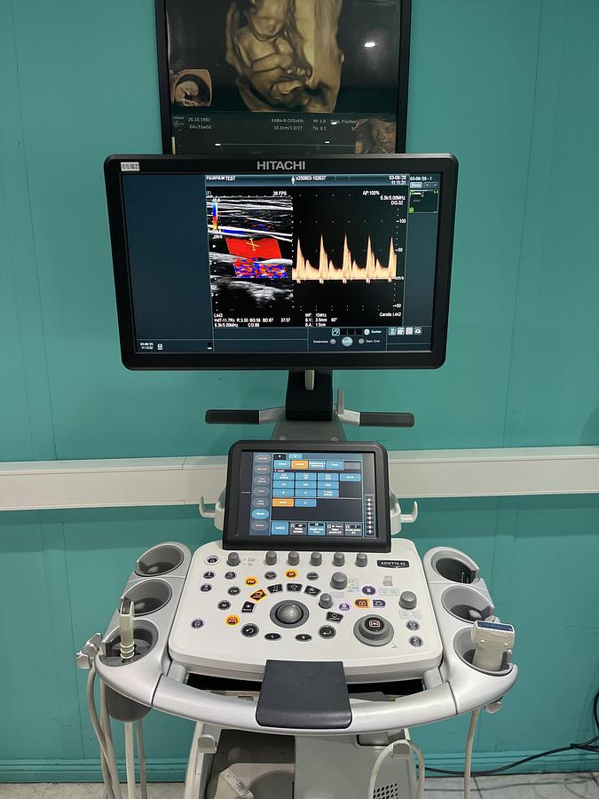 Gebraucht Hitachi ALOKA Arietta 65 Ultraschallgerät mit zwei Sonden