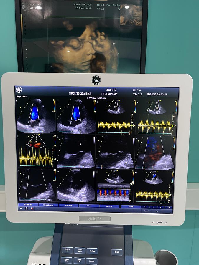 Gebraucht GE Vivid T8 Ultraschallgerät mit 3Sc-RS Kardiosonde