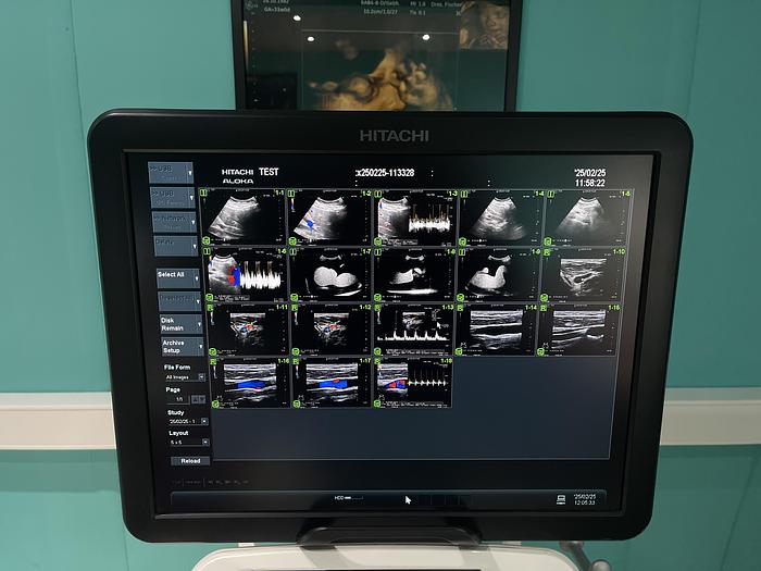 Gebraucht Hitachi ALOKA Arietta V70 Ultraschallgerät mit zwei Sonden und Fußschalter