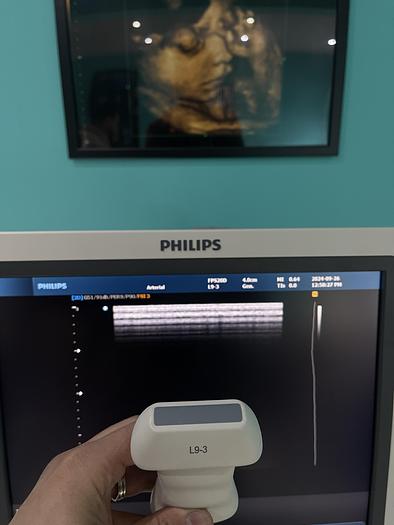 Used Philips HD9 Ultraschallgerät mit drei Sonden