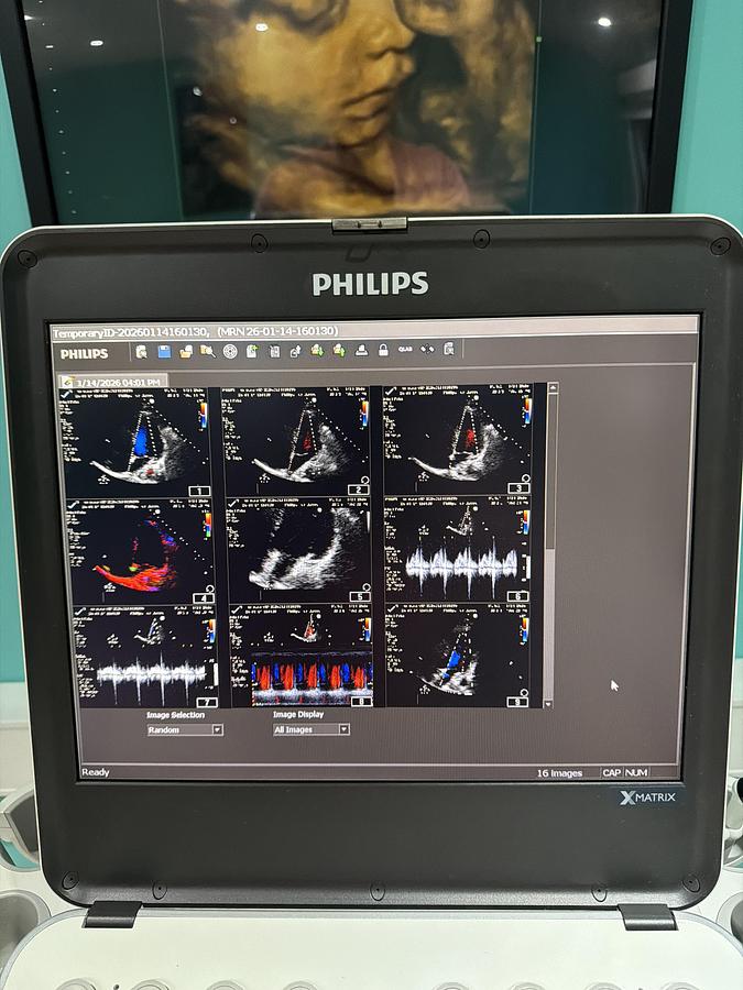 Gebraucht Philips CX50 XMATRIX HW E.0 SW 5.5.3 Ultraschallgerät mit zwei Sonden