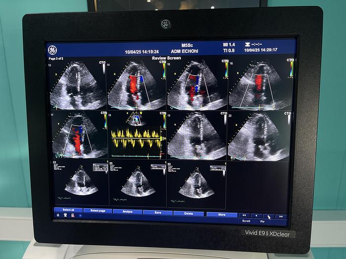 Gebraucht GE Vivid E9 XDclear Ultraschallgerät mit zwei Sonden und Drucker