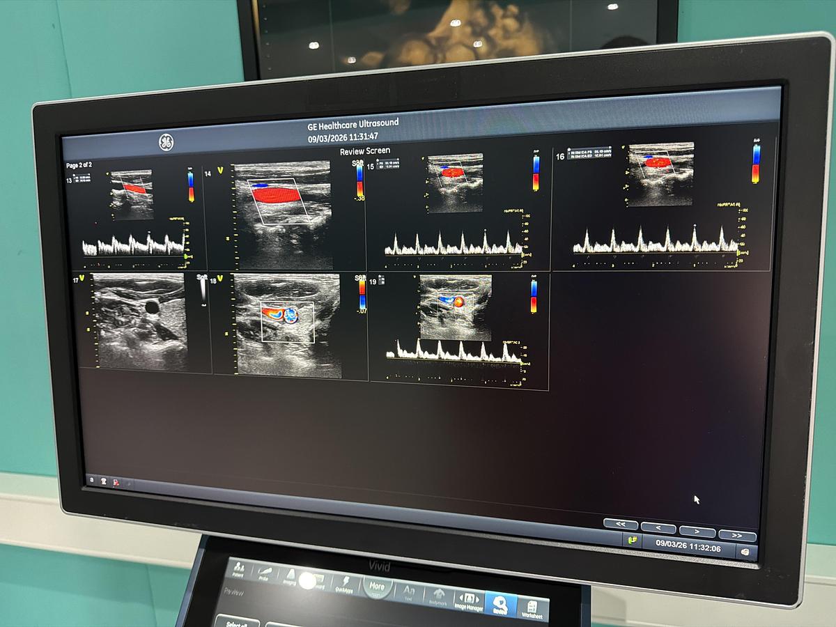 Gebraucht Vivid S70N Ultrasound 